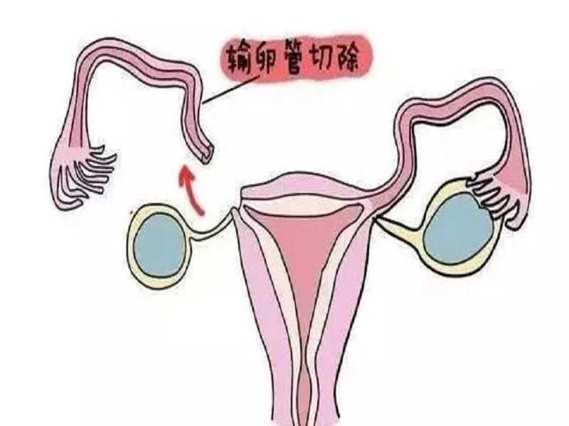 北京供卵试管生双胞胎孩子多吗（试管双胞胎和自然受孕双胞胎的区别）